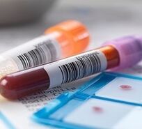 Labordiagnose von Prostatitis